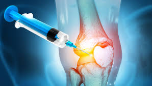 膝の再生医療注射のイメージ
